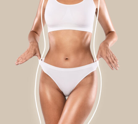 "Abdominal liposuction results in Marbella - Spain."