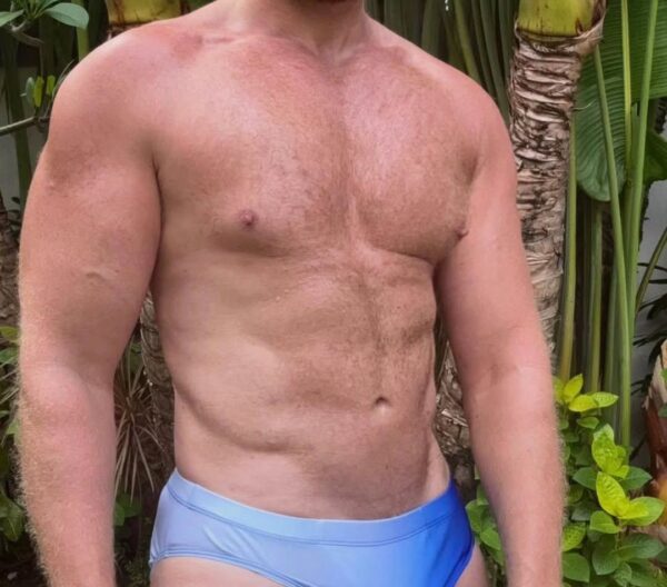 Paciente masculino con resultados visibles tras un aumento de masa muscular en Marbella - España.