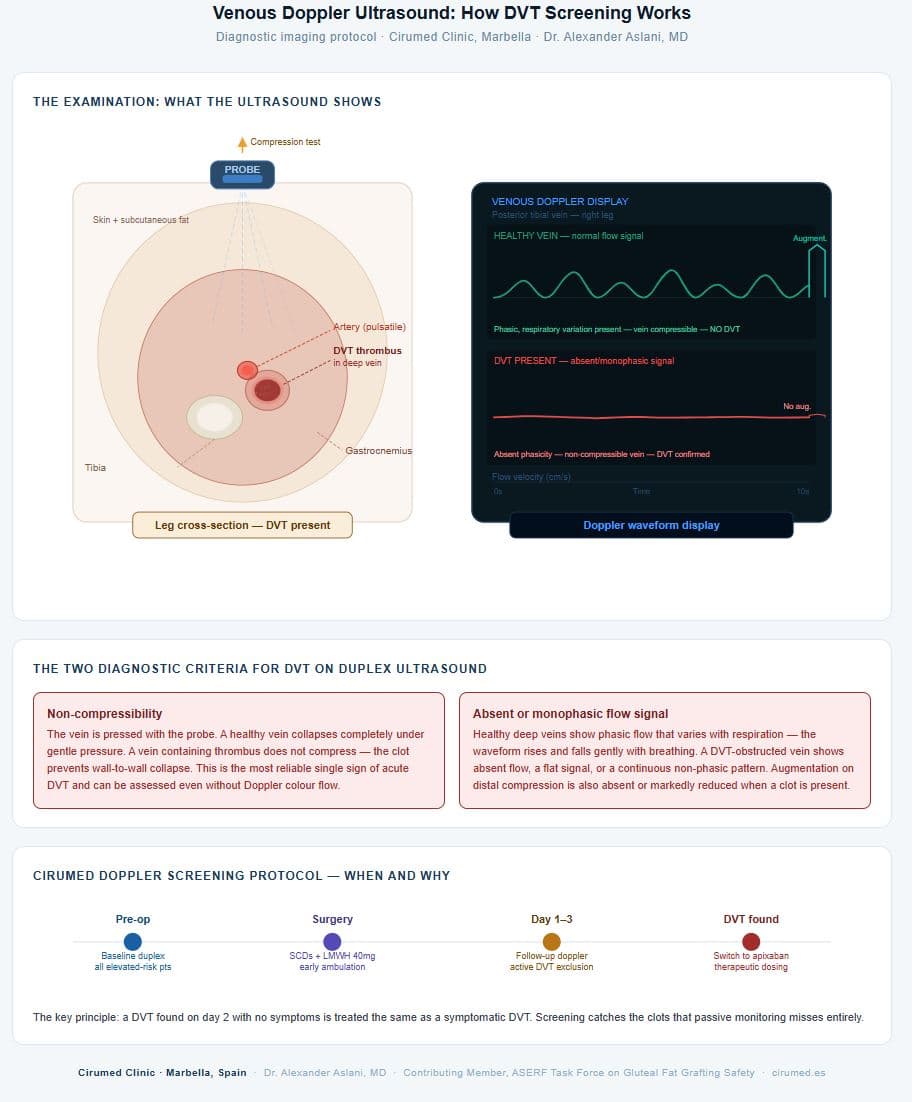 Venous Doppler examination for the prophylaxis of deep vein thrombosis