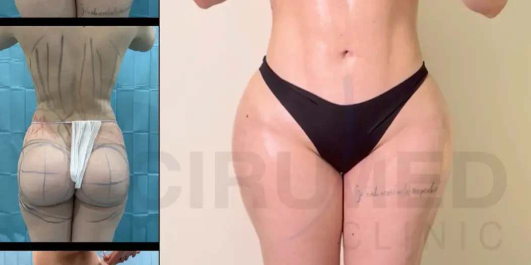Antes y después de una transformación corporal con forma de reloj de arena y proporción equilibrada entre cadera y piernas