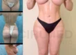 Antes y después de una transformación corporal con forma de reloj de arena y proporción equilibrada entre cadera y piernas