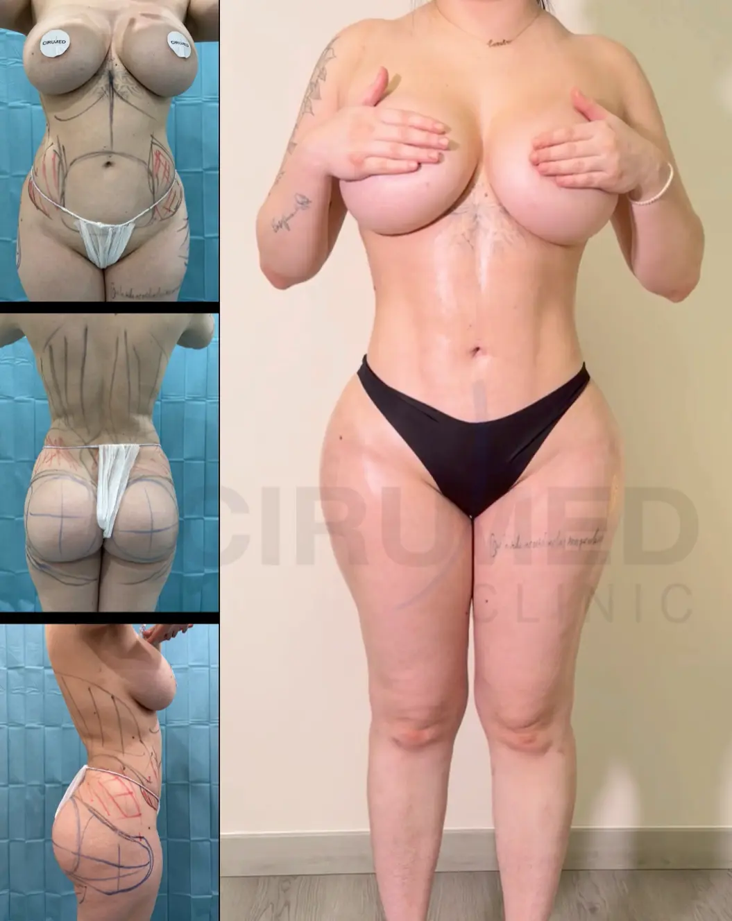 Antes y después de una transformación corporal con forma de reloj de arena y proporción equilibrada entre cadera y piernas